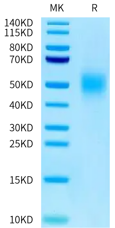Human CEACAM-5 (323-500) on Tris-Bis PAGE under reduced condition. The purity is greater than 95%.Recombinant Human CEACAM-5/CD66e (323-500) Protein