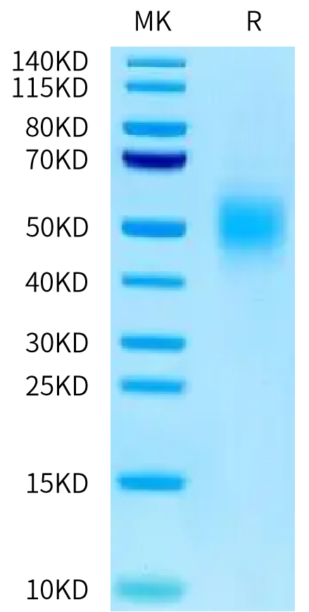 Human CEACAM-5 (323-500) on Tris-Bis PAGE under reduced condition. The purity is greater than 95%.Recombinant Human CEACAM-5/CD66e (323-500) Protein
