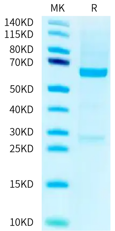 Human ROR1 on Tris-Bis PAGE under reduced condition. The purity is greater than 95%.Recombinant Human ROR1 Protein, Active
