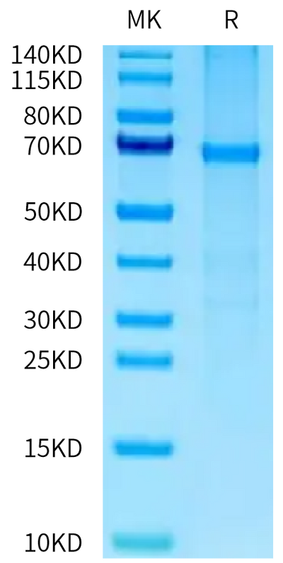 Human PTP alpha on Bis-Tris PAGE under reduced condition. The purity is greater than 90%.Recombinant Human PTP alpha/PTPRA Protein