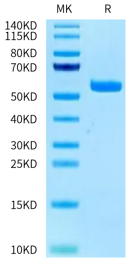 Human HLA-A*03:01&B2M&KRAS G12V (VVGAVGVGK) Monomer on Tris-Bis PAGE under reduced condition. The purity is greater than 95%.Recombinant Human HLA-A*03:01&B2M&KRAS G12V (VVGAVGVGK) Monomer Protein