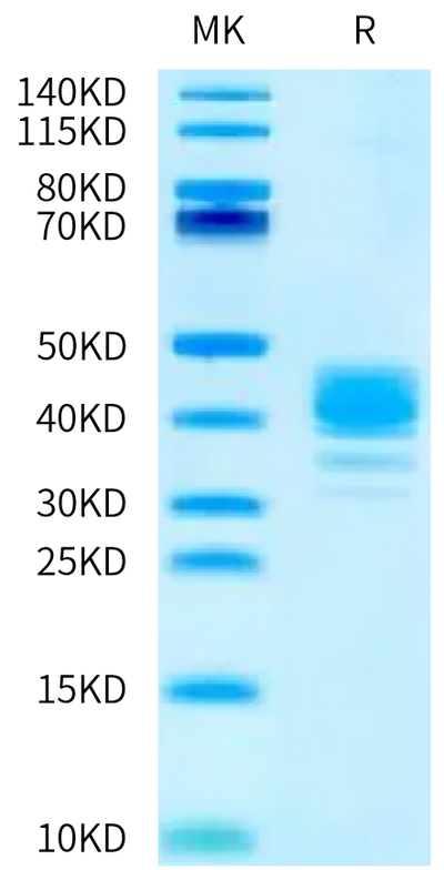 Human CLEC4M on Tris-Bis PAGE under reduced condition. The purity is greater than 95%.Recombinant Human CLEC4M/CD299 Protein