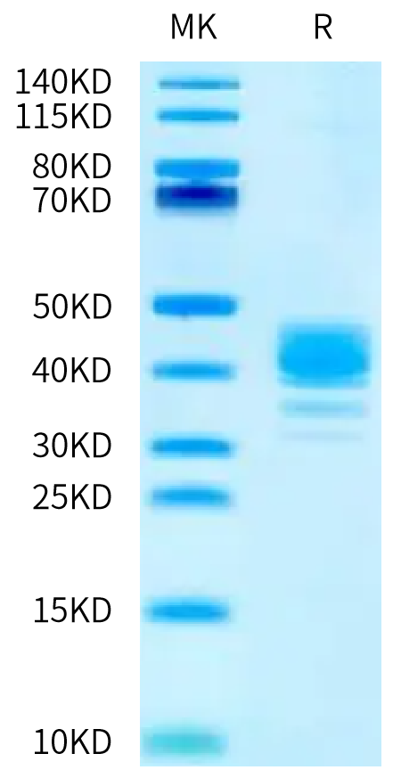 Human CLEC4M on Tris-Bis PAGE under reduced condition. The purity is greater than 95%.Recombinant Human CLEC4M/CD299 Protein