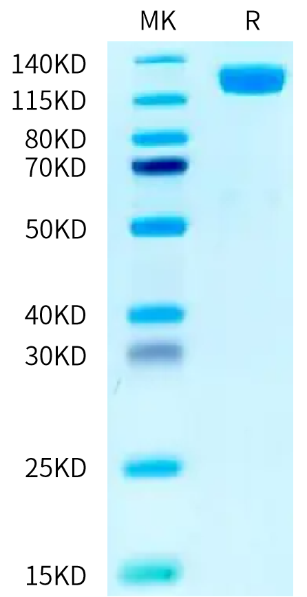 Human OSMR on Tris-Bis PAGE under reduced condition. The purity is greater than 95%.Recombinant Human OSMR Protein, Active