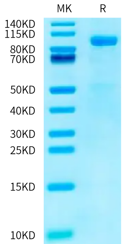 Human CDH16 on Tris-Bis PAGE under reduced condition. The purity is greater than 95%.Recombinant Human CDH16/Cadherin 16 Protein, Active