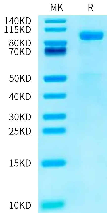 Human CDH16 on Tris-Bis PAGE under reduced condition. The purity is greater than 95%.Recombinant Human CDH16/Cadherin 16 Protein, Active