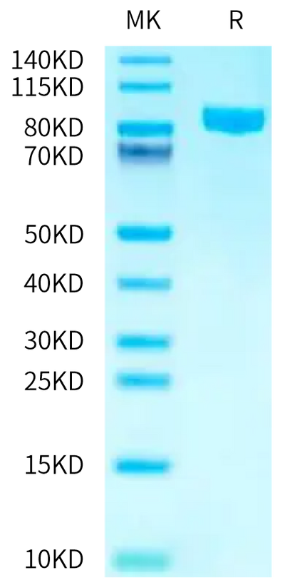 Human CD98 on Tris-Bis PAGE under reduced condition. The purity is greater than 95%.Recombinant Human CD98 Protein, Active