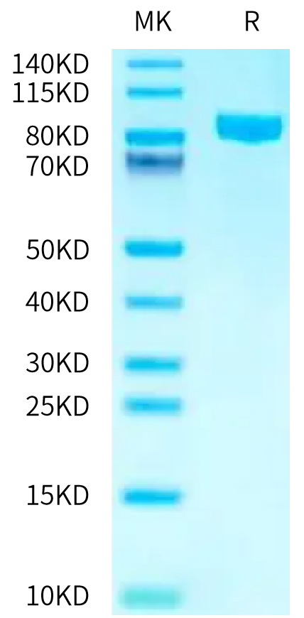 Human CD98 on Tris-Bis PAGE under reduced condition. The purity is greater than 95%.Recombinant Human CD98 Protein, Active