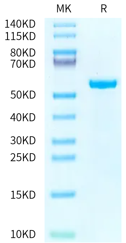 Human Peptide Ready HLA-B*07:02&B2M Monomer on Tris-Bis PAGE under reduced condition. The purity is greater than 95%.Recombinant Human Peptide Ready HLA-B*07:02&B2M Monomer Protein, Active