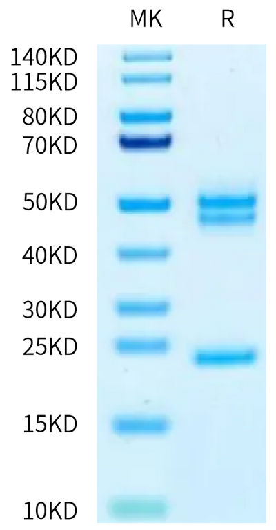 Biotinylated Human IL-23 alpha&Mouse IL-12 beta on Tris-Bis PAGE under reduced condition. The purity is greater than 95%.Biotinylated Human IL-23 alpha&Mouse IL-12 beta Protein, Active