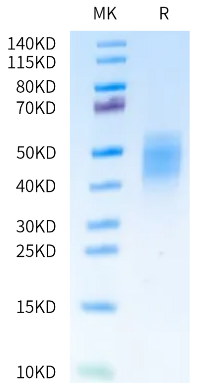 Human OSMR on Tris-Bis PAGE under reduced condition. The purity is greater than 95%.Recombinant Human OSMR Protein, Active