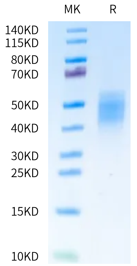 Human OSMR on Tris-Bis PAGE under reduced condition. The purity is greater than 95%.Recombinant Human OSMR Protein, Active
