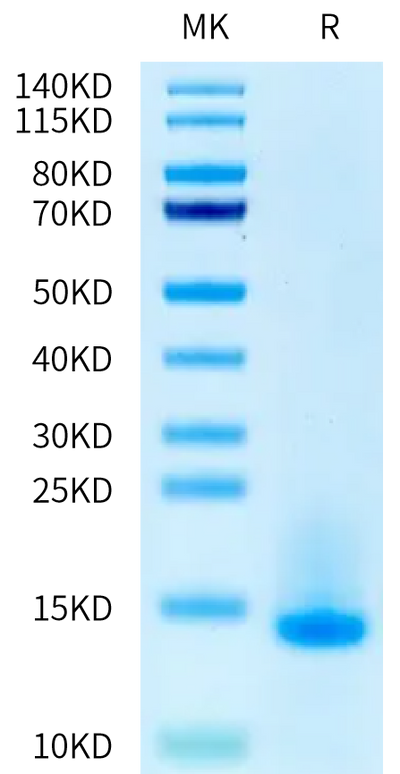 Mouse LY6G6D on Tris-Bis PAGE under reduced condition. The purity is greater than 95%.Recombinant Mouse LY6G6D Protein