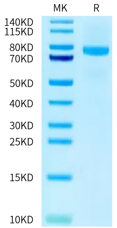 Canine LRRC15 on Tris-Bis PAGE under reduced condition. The purity is greater than 95%.Recombinant Canine LRRC15/LIB Protein