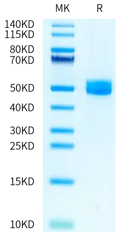 Rat IL-13Ra2 on Tris-Bis PAGE under reduced condition. The purity is greater than 95%.Recombinant Rat IL-13Ra2 Protein, Active