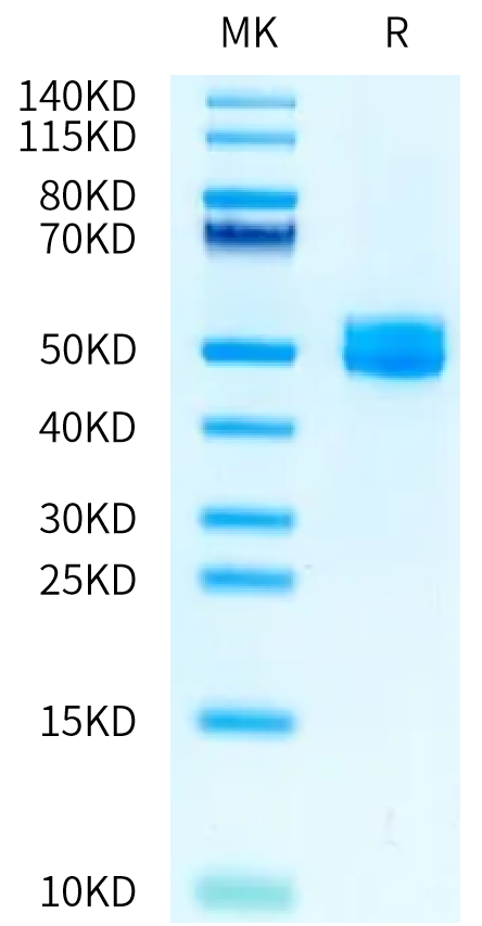 Rat IL-13Ra2 on Tris-Bis PAGE under reduced condition. The purity is greater than 95%.Recombinant Rat IL-13Ra2 Protein, Active