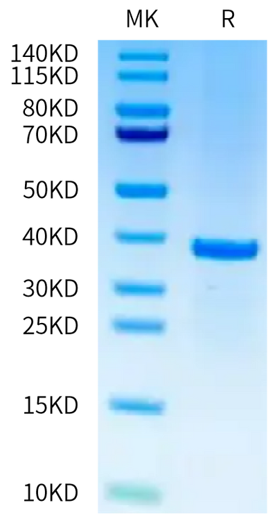 Cynomolgus SFRP2 on Tris-Bis PAGE under reduced condition. The purity is greater than 95%.Recombinant Cynomolgus SFRP2 Protein