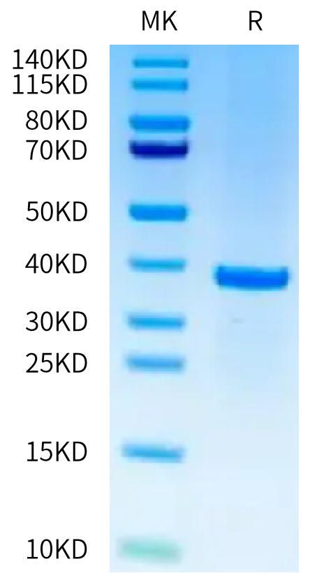 Cynomolgus SFRP2 on Tris-Bis PAGE under reduced condition. The purity is greater than 95%.Recombinant Cynomolgus SFRP2 Protein