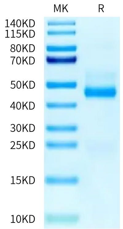 RSV (B) Post-fusion glycoprotein F0 on Tris-Bis PAGE under reduced condition. The purity is greater than 95%.Recombinant RSV (B) Post-fusion glycoprotein F0 Protein, Active