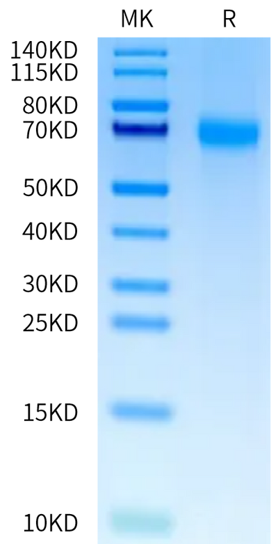 Human OSMR on Tris-Bis PAGE under reduced condition. The purity is greater than 95%.Recombinant Human OSMR Protein, Active