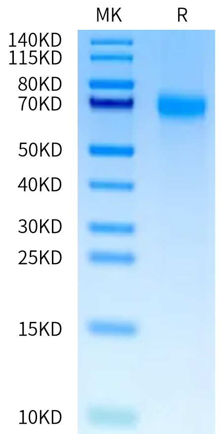 Human OSMR on Tris-Bis PAGE under reduced condition. The purity is greater than 95%.Recombinant Human OSMR Protein, Active