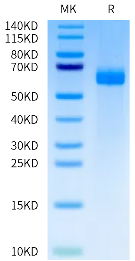Human DLL4 on Tris-Bis PAGE under reduced condition. The purity is greater than 95%.Recombinant Human DLL4 Protein, Active