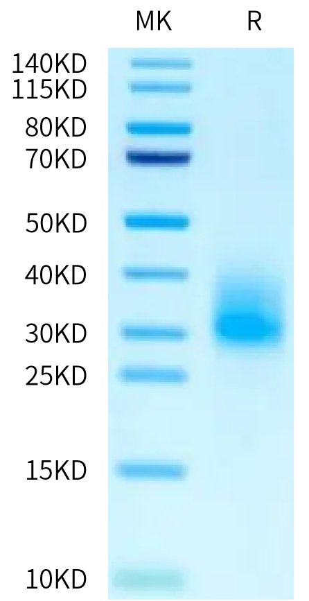 Mouse IL-3 on Tris-Bis PAGE under reduced condition. The purity is greater than 95%.Recombinant Mouse IL-3 Protein