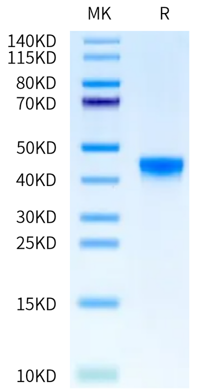 Rat FGL2 on Bis-Tris PAGE under reduced condition. The purity is greater than 95%.Recombinant Rat FGL2 Protein, Active