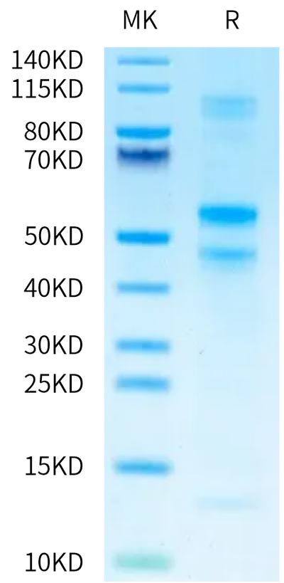 Human Latent TGF beta 3 on Tris-Bis PAGE under reduced condition. The purity is greater than 95%.Recombinant Human Latent TGF beta 3 Protein, Active