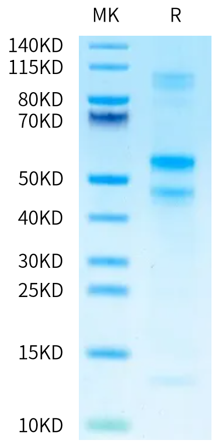 Human Latent TGF beta 3 on Tris-Bis PAGE under reduced condition. The purity is greater than 95%.Recombinant Human Latent TGF beta 3 Protein, Active