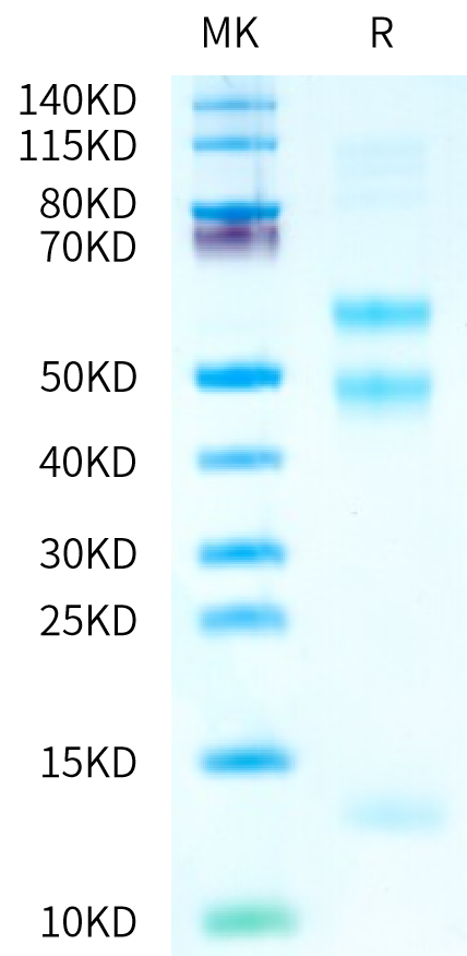 Biotinylated Human Latent TGF beta 3 on Tris-Bis PAGE under reduced condition. The purity is greater than 95%.Biotinylated Human Latent TGF beta 3 Protein (Primary Amine Labeling), Active