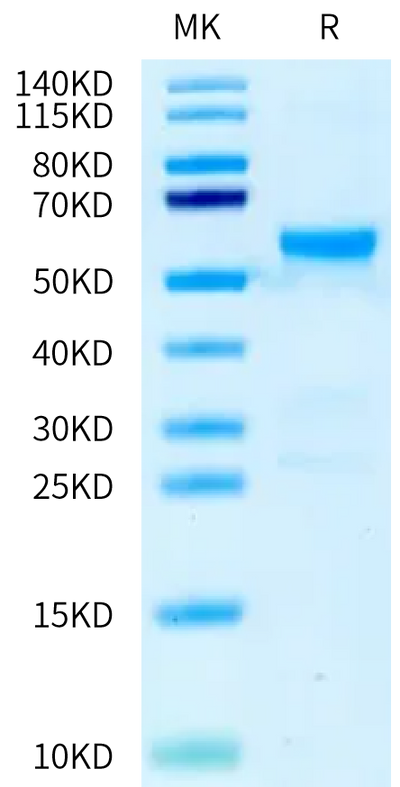 Human GLP-1R on Tris-Bis PAGE under reduced condition. The purity is greater than 95%.Recombinant Human GLP-1R Protein, Active