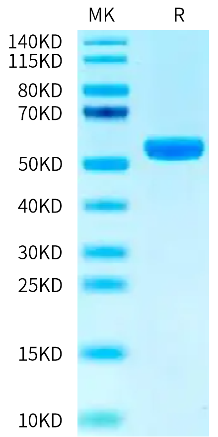 Biotinylated Human HLA-A*02:01&B2M&PRAME (ALYVDSLFFL) Monomer on Tris-Bis PAGE under reduced condition. The purity is greater than 95%.Biotinylated Human HLA-A*02:01&B2M&PRAME (ALYVDSLFFL) Monomer Protein, Active