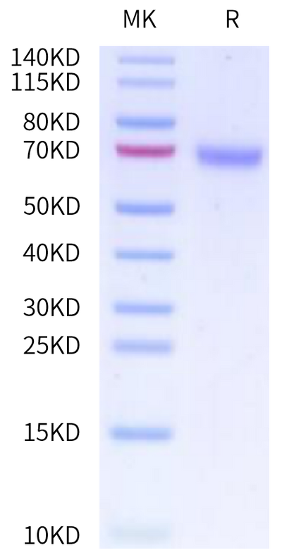 Human CD48 on Tris-Bis PAGE under reduced condition. The purity is greater than 95%.Recombinant Human CD48/SLAMF2 Protein, Active