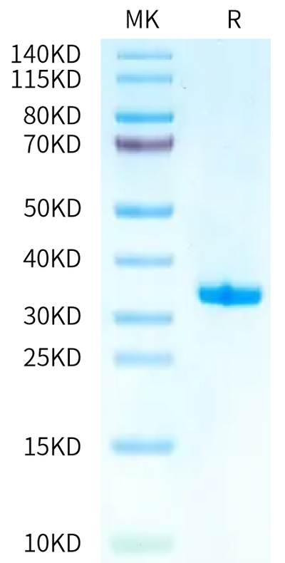 Biotinylated Human IgE on Tris-Bis PAGE under reduced condition. The purity is greater than 95%.Biotinylated Human IgE Protein, Active