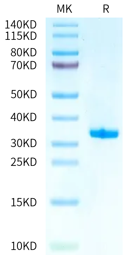 Biotinylated Human IgE on Tris-Bis PAGE under reduced condition. The purity is greater than 95%.Biotinylated Human IgE Protein, Active