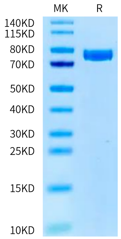 Human KLKB1 on Tris-Bis PAGE under reduced condition. The purity is greater than 95%.Recombinant Human KLKB1 Protein