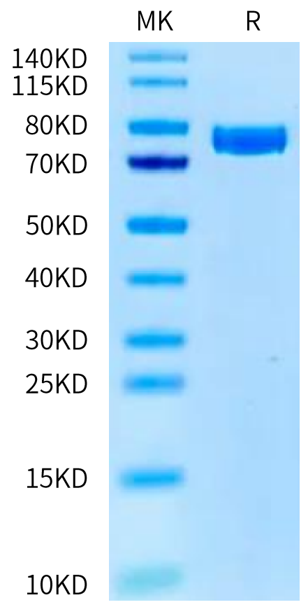 Human KLKB1 on Tris-Bis PAGE under reduced condition. The purity is greater than 95%.Recombinant Human KLKB1 Protein