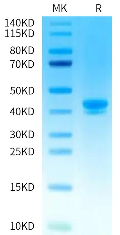 Human LY6E on Tris-Bis PAGE under reduced condition. The purity is greater than 95%.Recombinant Human LY6E Protein, Active