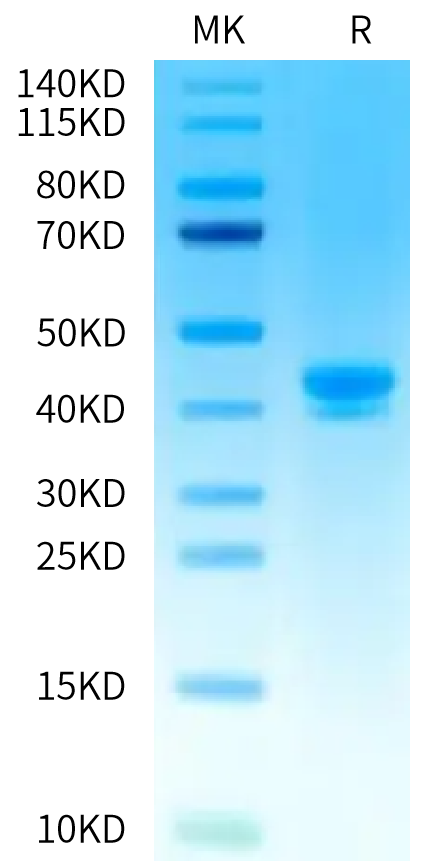 Human LY6E on Tris-Bis PAGE under reduced condition. The purity is greater than 95%.Recombinant Human LY6E Protein, Active