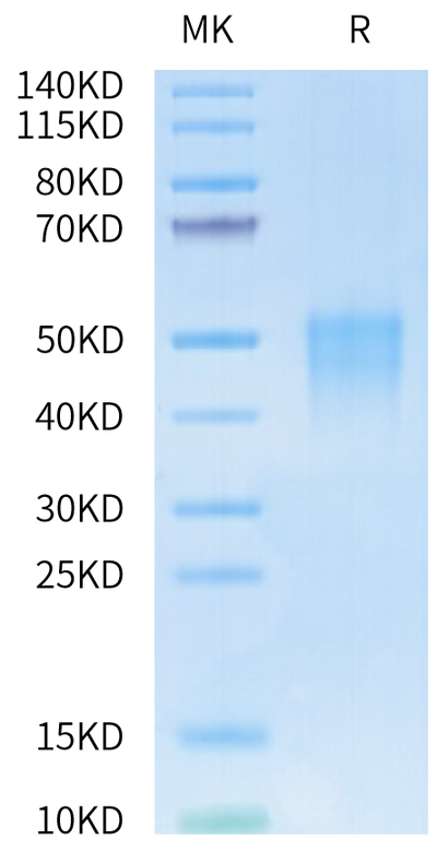Biotinylated Human/Cynomolgus/Rhesus macaque CD28 on Tris-Bis PAGE under reduced condition. The purity is greater than 95%.
