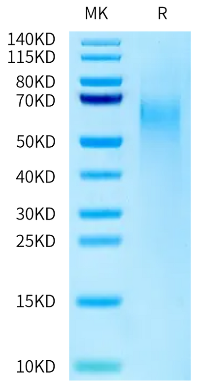 Cynomolgus CD27 Ligand on Tris-Bis PAGE under reduced condition. The purity is greater than 95%.Recombinant Cynomolgus CD27 Ligand/CD70 Protein, Active