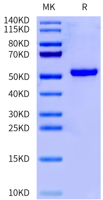 Human IL-1 alpha on Tris-Bis PAGE under reduced condition. The purity is greater than 95%.Recombinant Human IL-1 alpha/IL-1A Protein, Active