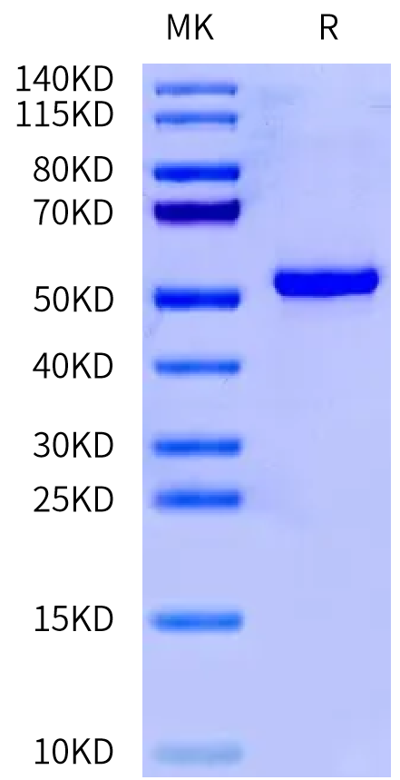 Human IL-1 alpha on Tris-Bis PAGE under reduced condition. The purity is greater than 95%.Recombinant Human IL-1 alpha/IL-1A Protein, Active