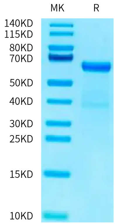 Mouse ADAM8 on Tris-Bis PAGE under reduced condition. The purity is greater than 95%.Recombinant Mouse ADAM8 Protein