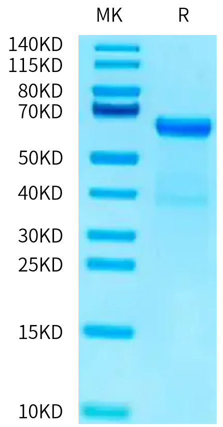 Mouse ADAM8 on Tris-Bis PAGE under reduced condition. The purity is greater than 95%.Recombinant Mouse ADAM8 Protein