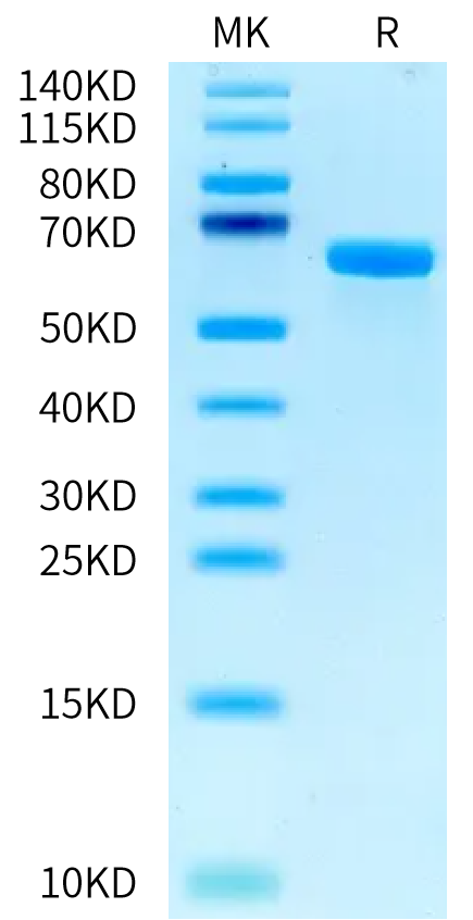 Biotinylated Human Alkaline Phosphatase (Placental type) on Tris-Bis PAGE under reduced condition. The purity is greater than 95%.Biotinylated Human Alkaline Phosphatase (Placental type) /ALPP Protein (Primary Amine Labeling), Active