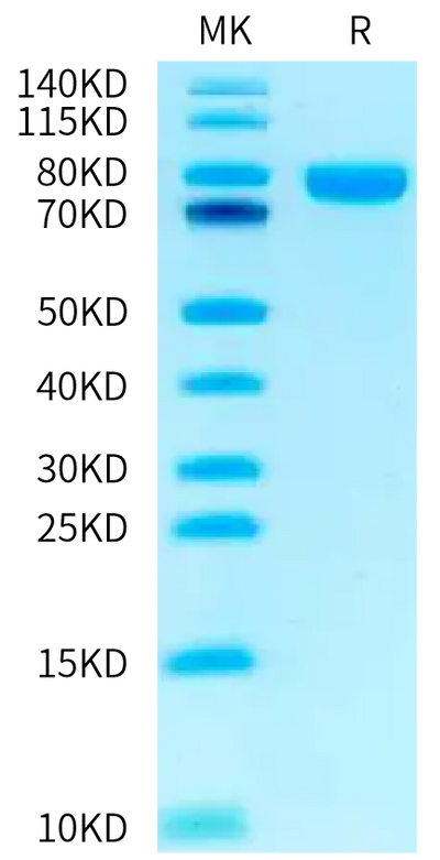Biotinylated Human NRG1 Beta 1 on Tris-Bis PAGE under reduced condition. The purity is greater than 95%.Biotinylated Human NRG1 Beta 1 Protein (Primary Amine Labeling), Active