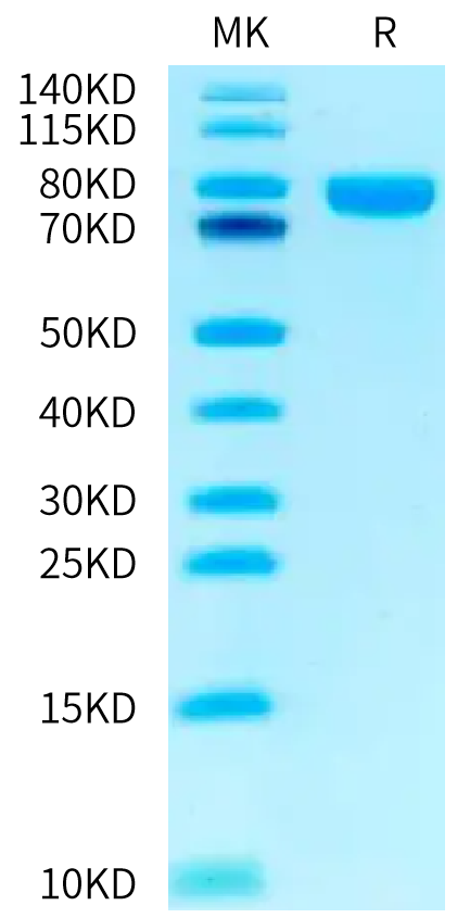 Biotinylated Human NRG1 Beta 1 on Tris-Bis PAGE under reduced condition. The purity is greater than 95%.Biotinylated Human NRG1 Beta 1 Protein (Primary Amine Labeling), Active