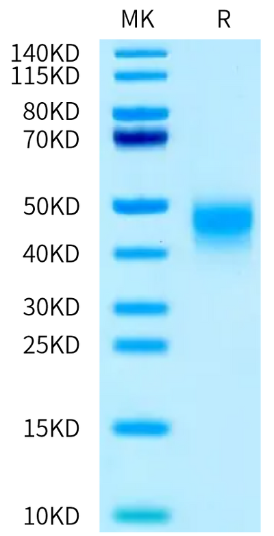 Mouse IL-4 R alpha on Tris-Bis PAGE under reduced condition. The purity is greater than 95%.Recombinant Mouse IL-4 R alpha/CD124 Protein